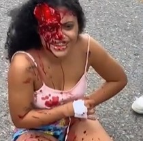 Chick in Total Shock with Face Scalped.