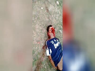 Got His Face Split Open