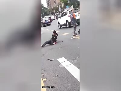 Guys leg broken after accident on the road.