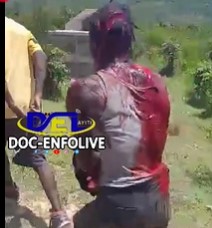 Haitian Bandit Chopped & Stoned To Death