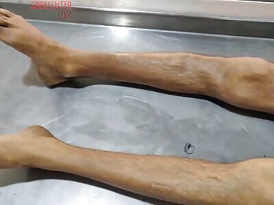 Annotated autopsy of electrocuted man