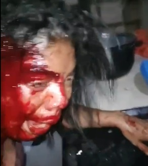 Woman Stabbed by Lesbian Lover During Breakup