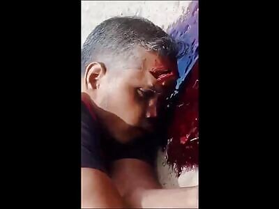 Biker Still Breathing As Blood & Brain Coming Out Of His Skull