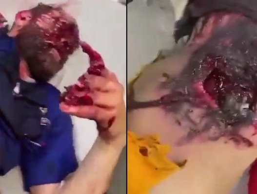 [BETTER QUALITY] Horrific Footage after Israeli Pager Bomb Attack