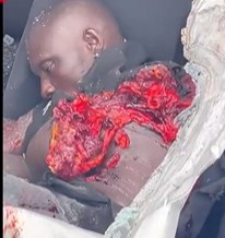 Removing His Torn Corpse From Wreckage