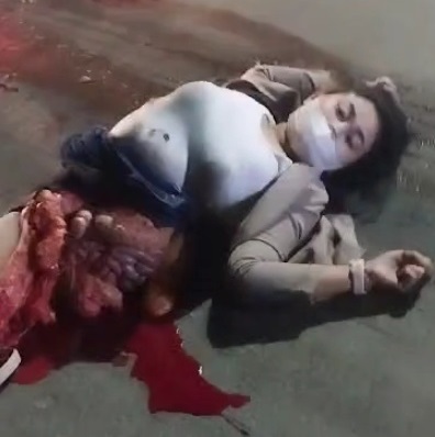 Pretty Woman Left Mangled and Fucked up From Accident In Indonesia