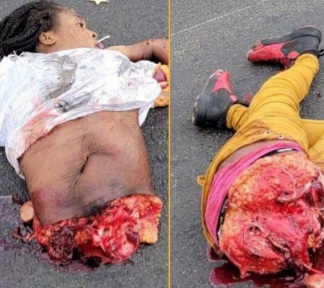 DANG: Girl Split in Half From Motorcycle Accident.