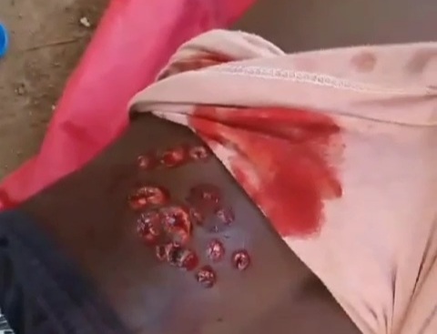 Young man victime of clashes between gangs in Haiti 