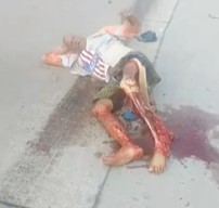 Dude Gets Shredded Up....