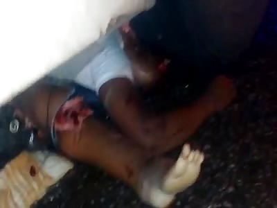 Nice gore,  smashed by truck