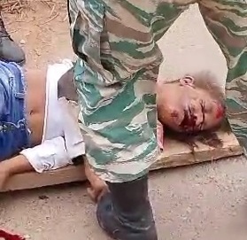 A young woman was run over lost her life on the way to the hospital 