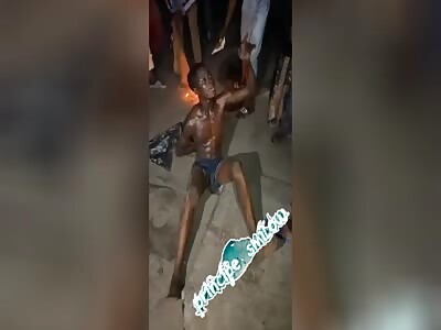 African man was set on fire