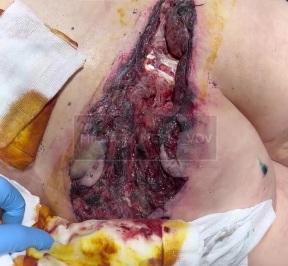 Russian soldier rotten ass 