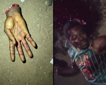 Another rival hacked and dismembered by the BLACK AXE GANG 