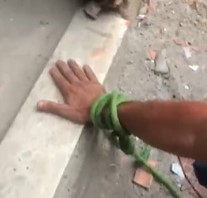 Finger Cut off Due to Robberies