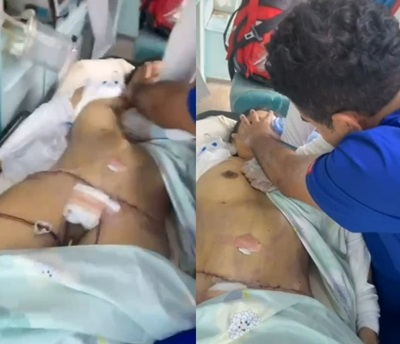 42 Year Old Woman Dies After Liposuction Surgery in Peru