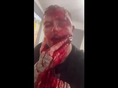 Brit Has his face Destroyed