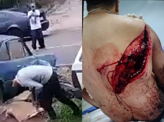 Bloody War Of Neighbors In Santa Catarina (w/Aftermath)