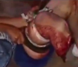 Motorcyclist lost his leg after a horrific crash 