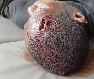 Another viking member butchered by the BLACK AXE GANG 