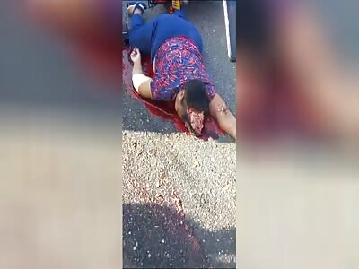 biker had a cracked skull whitening whitening