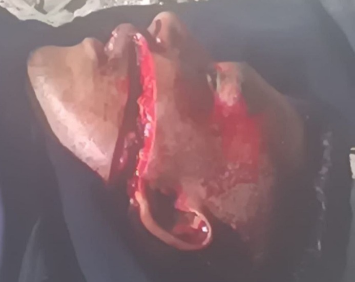 Colombian man hacked to death by machete 