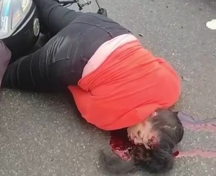 Collision between two females motorcyclist leave one of them dead 