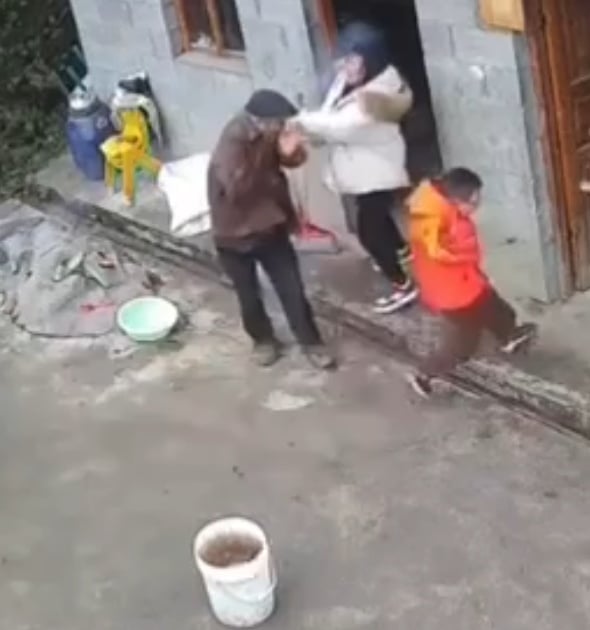 Kid Accidentally Injured His Mother's Face When He Set Off a Firecrack