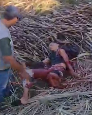 I am Dismembered on Top of Some Foliage in a Horrible Accident