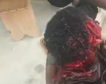 Thief captured and had his head sliced with machete 