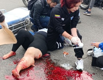 Fat female motorcyclist horrifically crashed her leg after collision 
