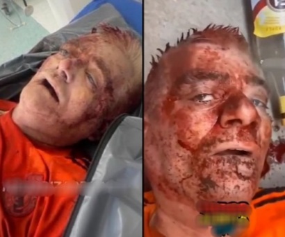 Pedophile Killed by Angry Crowds. 