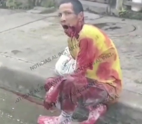 Ecuadorian man recieve a bullet to the face from sicario 