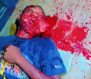 Rival executed by the BLACK AXE GANG with a gunshot to the face 