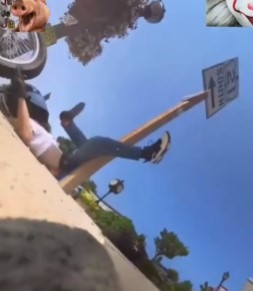 motorcyclist collided with a pole and broke his leg