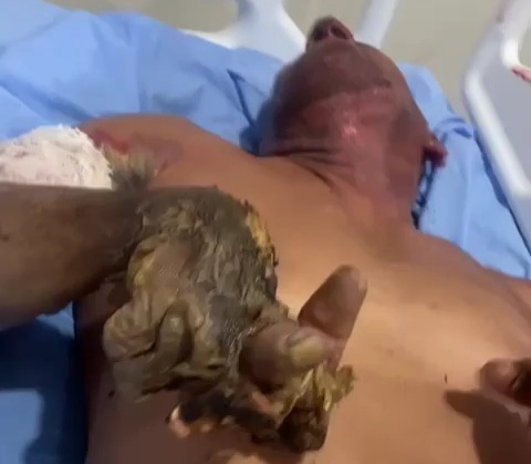 Worker hospitalized after he was electrocuted 