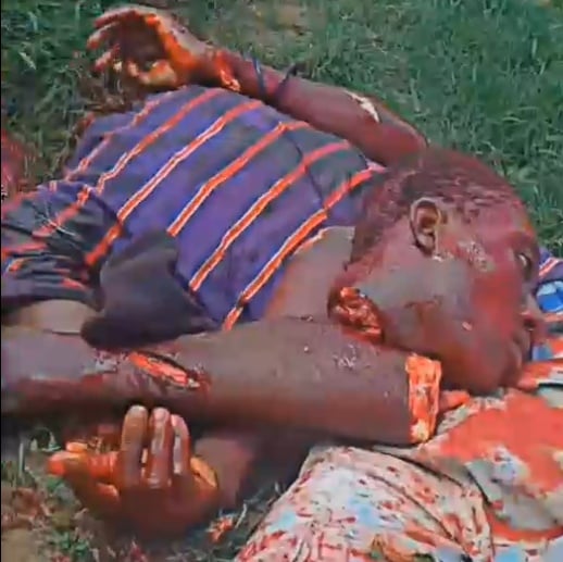 Bandit Dismembered, Ready For Flames In Haiti