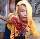 Man Loses Hand In Work Accident