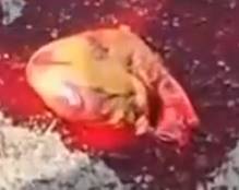 Heart On The Road After Cyclist Being Crushed By Bus