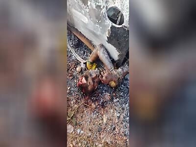 Victim burned in horrífic accident 