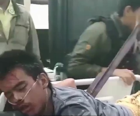 Young man with peace of iron stuck in his back 