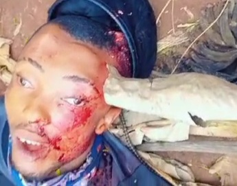 Butchered EIYE MEMBER with peace of wood stuck in his head 