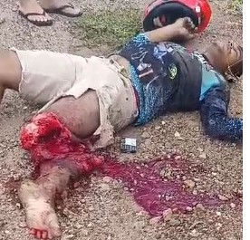 terrible accident with biker