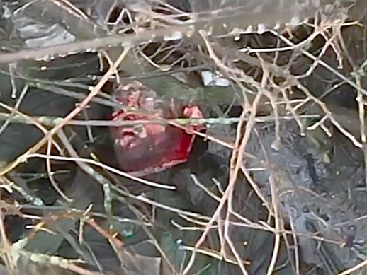 Compilation — The Eternal Suffering & Defeat