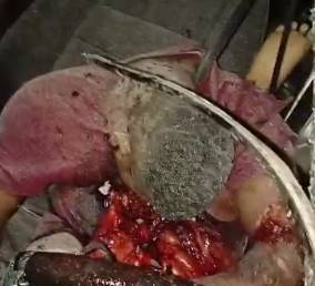 Aftermath of Brutal Car Accident