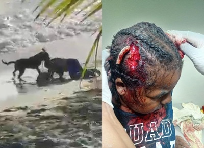 Woman Attacked by Dog on Beach in Dominican Republic (Full)