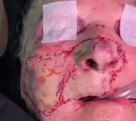 a shepherd dog tore apart old woman face