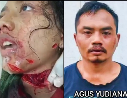 Lunatic Father nearly Decapitates his Daughter 