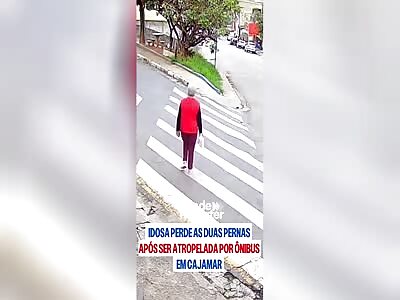 has legs crushed by buses