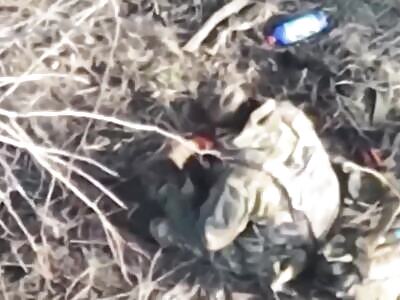 DAMN: Solider Cuts off his own Leg